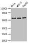 Cholinergic Receptor Nicotinic Beta 1 Subunit antibody, LS-C682166, Lifespan Biosciences, Western Blot image 