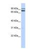 Tripartite Motif Containing 67 antibody, NBP1-55028, Novus Biologicals, Western Blot image 