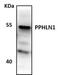 Periphilin 1 antibody, NBP1-89480, Novus Biologicals, Western Blot image 