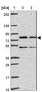 Tetratricopeptide Repeat Domain 30A antibody, PA5-62465, Invitrogen Antibodies, Western Blot image 