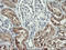Gamma-Butyrobetaine Hydroxylase 1 antibody, LS-C174488, Lifespan Biosciences, Immunohistochemistry frozen image 