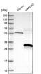  antibody, NBP1-91638, Novus Biologicals, Western Blot image 