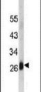 CD302 antigen antibody, PA5-13452, Invitrogen Antibodies, Western Blot image 