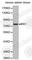 MX Dynamin Like GTPase 1 antibody, A1780, ABclonal Technology, Western Blot image 