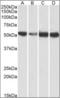 ATP Synthase F1 Subunit Alpha antibody, orb375551, Biorbyt, Western Blot image 