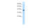 Transcription Factor EB antibody, 31-188, ProSci, Enzyme Linked Immunosorbent Assay image 