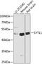 Synaptotagmin 11 antibody, 23-456, ProSci, Western Blot image 