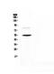 Angiopoietin Like 3 antibody, A02929, Boster Biological Technology, Western Blot image 