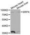 Sushi Repeat Containing Protein X-Linked antibody, A1217, ABclonal Technology, Western Blot image 