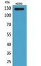 ABL Proto-Oncogene 2, Non-Receptor Tyrosine Kinase antibody, A02715, Boster Biological Technology, Western Blot image 