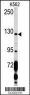 Platelet Derived Growth Factor Receptor Alpha antibody, MBS9204855, MyBioSource, Western Blot image 