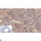Platelet Derived Growth Factor Receptor Alpha antibody, LS-C814215, Lifespan Biosciences, Immunohistochemistry paraffin image 