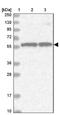 RNA Guanine-7 Methyltransferase antibody, NBP1-80841, Novus Biologicals, Western Blot image 