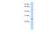 Ferritin Heavy Chain Like 17 antibody, MBS5300189, MyBioSource, Western Blot image 