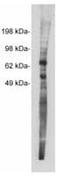 Netrin 1 antibody, PA1-12869, Invitrogen Antibodies, Western Blot image 