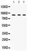 Complement Factor B antibody, PA5-79033, Invitrogen Antibodies, Western Blot image 
