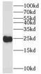 RAN, Member RAS Oncogene Family antibody, FNab07100, FineTest, Western Blot image 