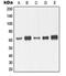Matrix Metallopeptidase 14 antibody, LS-C352537, Lifespan Biosciences, Western Blot image 