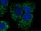 Death Domain Associated Protein antibody, 20489-1-AP, Proteintech Group, Immunofluorescence image 