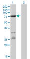 Acyl-CoA Synthetase Long Chain Family Member 5 antibody, LS-C133760, Lifespan Biosciences, Western Blot image 