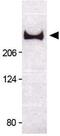 Tumor Protein P53 Binding Protein 1 antibody, GTX30658, GeneTex, Western Blot image 