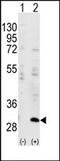 Insulin Like Growth Factor Binding Protein 3 antibody, AP14347PU-N, Origene, Western Blot image 