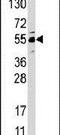 Jumonji Domain Containing 4 antibody, PA5-11151, Invitrogen Antibodies, Western Blot image 