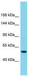 ArfGAP With GTPase Domain, Ankyrin Repeat And PH Domain 11 antibody, TA333548, Origene, Western Blot image 