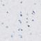 Solute Carrier Family 12 Member 1 antibody, NBP1-80993, Novus Biologicals, Immunohistochemistry paraffin image 