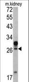 Homeobox A5 antibody, LS-C164975, Lifespan Biosciences, Western Blot image 