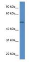 Arylsulfatase B antibody, NBP1-79727, Novus Biologicals, Western Blot image 