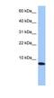 Transition Protein 1 antibody, NBP1-55356, Novus Biologicals, Western Blot image 