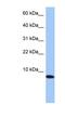 STP1 antibody, NBP1-55356, Novus Biologicals, Western Blot image 