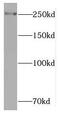 Retinoic Acid Induced 1 antibody, FNab07090, FineTest, Western Blot image 