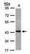 ST3 Beta-Galactoside Alpha-2,3-Sialyltransferase 2 antibody, GTX103942, GeneTex, Western Blot image 