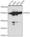 Serine And Arginine Rich Splicing Factor 6 antibody, LS-C749604, Lifespan Biosciences, Western Blot image 