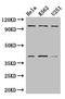 Proteasome 26S Subunit, Non-ATPase 2 antibody, LS-C395156, Lifespan Biosciences, Western Blot image 