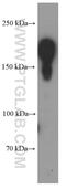 BRCA1 DNA Repair Associated antibody, 66267-1-Ig, Proteintech Group, Western Blot image 