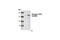 Large Tumor Suppressor Kinase 1 antibody, 9157S, Cell Signaling Technology, Western Blot image 