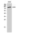 Protein Kinase CGMP-Dependent 2 antibody, STJ92256, St John