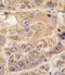 Low Density Lipoprotein Receptor Adaptor Protein 1 antibody, abx033819, Abbexa, Immunohistochemistry frozen image 