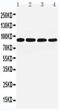 Transglutaminase 1 antibody, PA5-80119, Invitrogen Antibodies, Western Blot image 