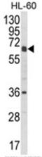 Cytochrome P450 Family 2 Subfamily C Member 18 antibody, AP17966PU-N, Origene, Western Blot image 
