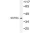 Somatostatin Receptor 4 antibody, LS-C177412, Lifespan Biosciences, Western Blot image 