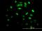 Iroquois Homeobox 3 antibody, H00079191-M05, Novus Biologicals, Immunocytochemistry image 