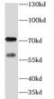 Methyltransferase Like 4 antibody, FNab05140, FineTest, Western Blot image 
