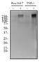 ATP Binding Cassette Subfamily A Member 1 antibody, NBP2-54792, Novus Biologicals, Western Blot image 