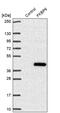 FKBP Prolyl Isomerase 10 antibody, PA5-63926, Invitrogen Antibodies, Western Blot image 