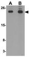 Translin antibody, GTX31440, GeneTex, Western Blot image 