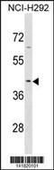 Serpin Family B Member 9 antibody, 60-787, ProSci, Western Blot image 